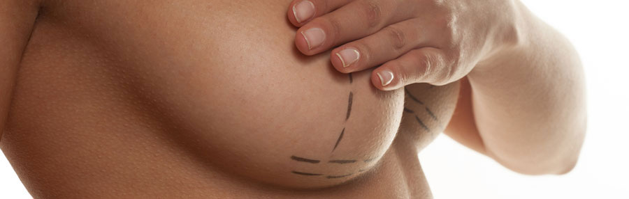 Going Under the Knife: Top Tips to Consider Before Breast Augmentation