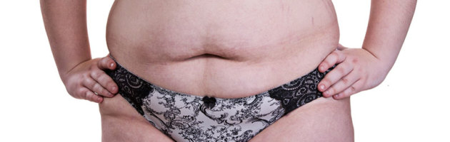 Can you access your Super Fund for Weight Loss Surgery?