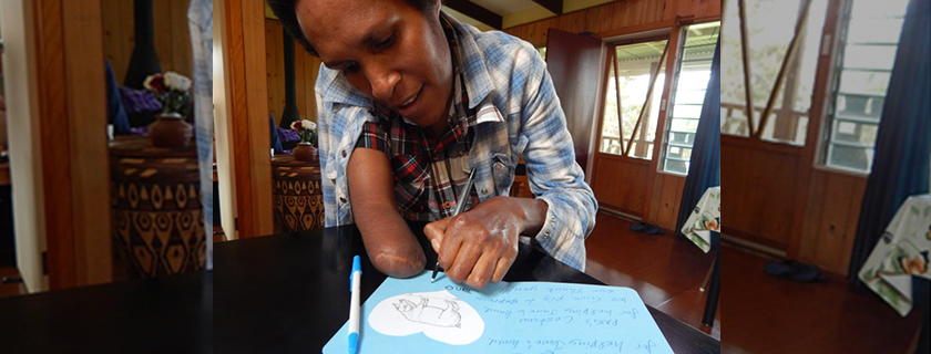 Hand surgery and therapy program delivered by Interplast helps PNG mum regain her independence