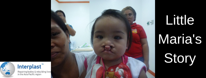 Baby Maria’s surgery gives her the best chance for a healthy life