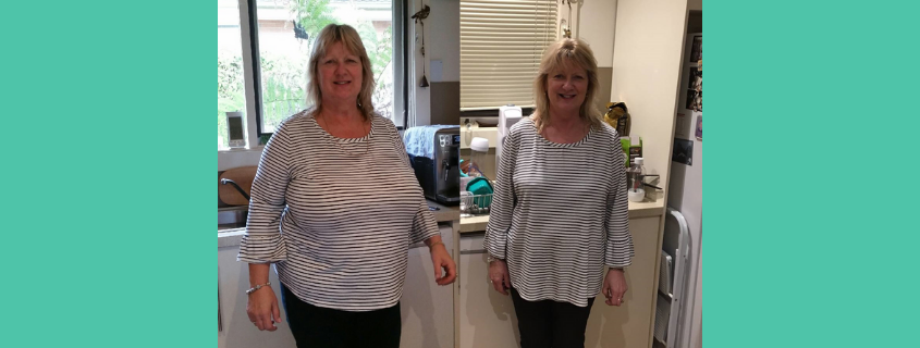 Dr Craig Rubinstein Breast Reduction Results – Sue’s Patient Story
