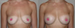 breast surgeon