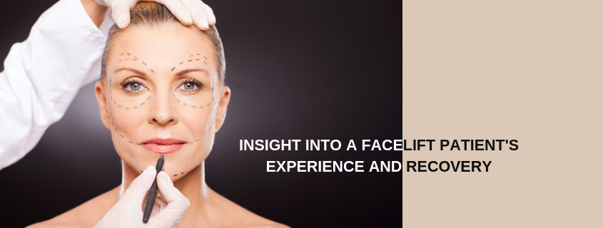 Real Facelift Patient Recovery with Dr Jack Zoumaras