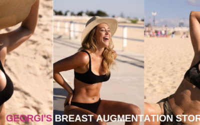Georgi’s Breast Augmentation Patient Story with Dr Nick Moncrieff