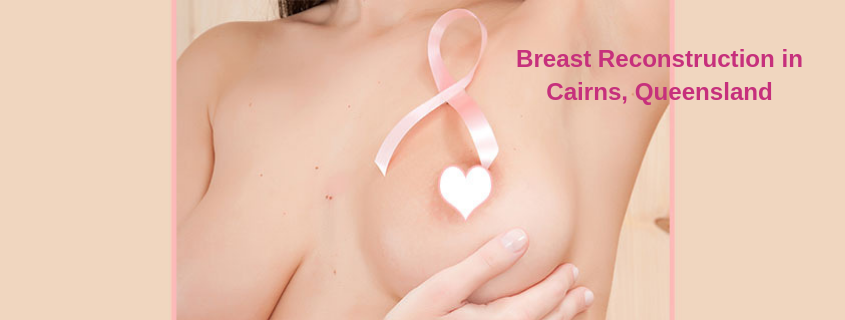 Breast Reconstruction in Cairns, Queensland