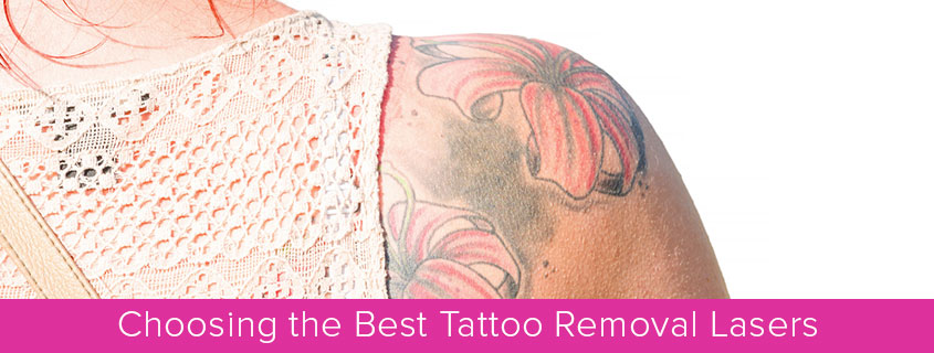 Choosing the Best Tattoo Removal Lasers
