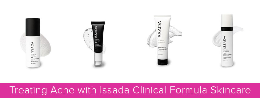 Treating Acne with Issada Clinical Formula Skincare
