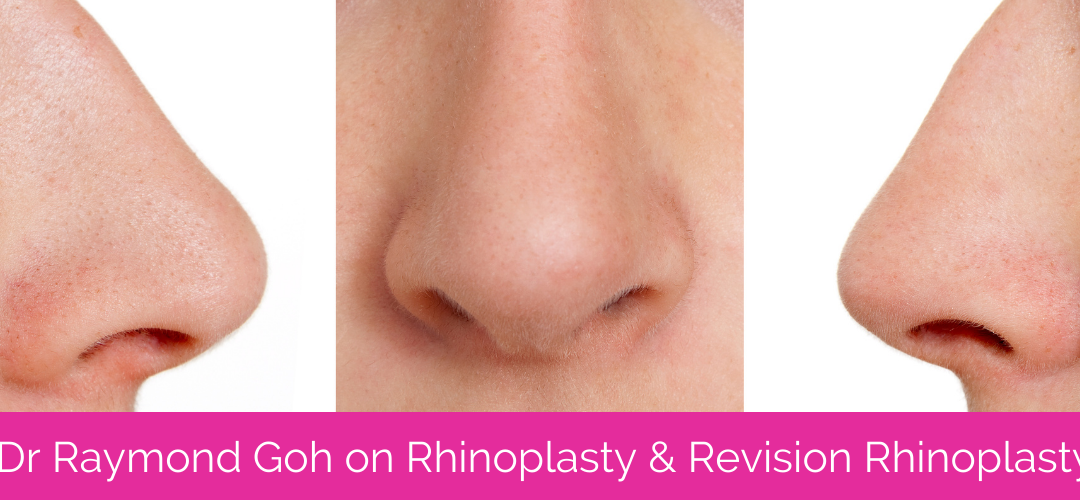 Rhinoplasty Surgery with Dr Raymond Goh, from Valley Plastic Surgery Brisbane
