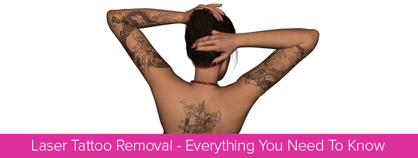 Laser Tattoo Removal – Everything You Need to Know