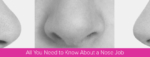 All You Need to Know About a Nose Job - Australian Rhinoplasty