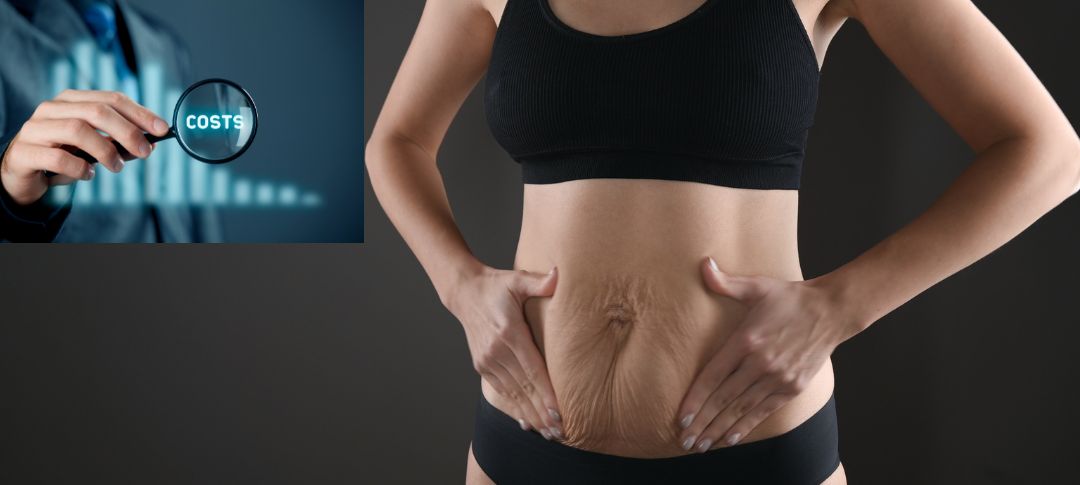 Cost of a Tummy Tuck Surgery in Australia